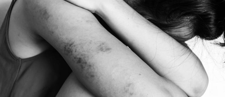 Delitos contra la libertad sexual