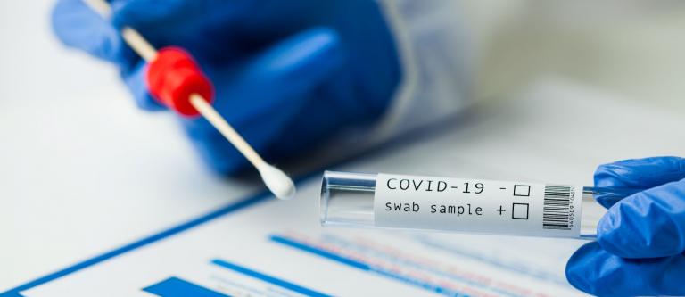 Test PCR evitar contagios covid