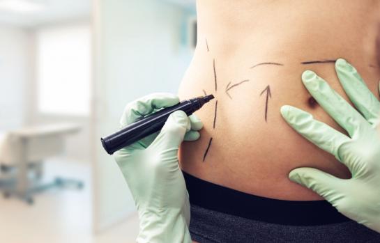 Cirugia estetica_imagen