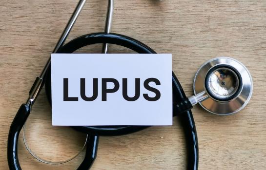 Lupus_enfermedad_imagen