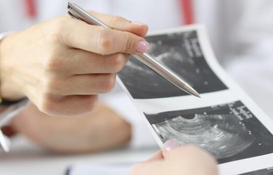 Ley organica de interrupcion del embarazo e informe del Poder Judicial_img