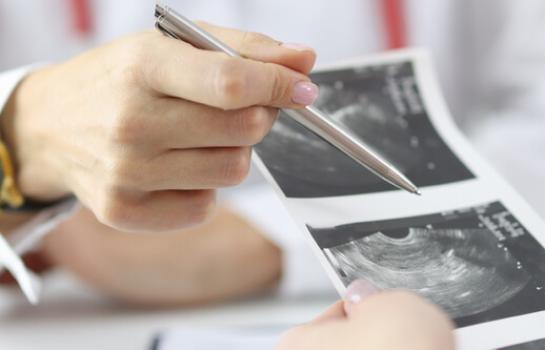 Ley organica de interrupcion del embarazo e informe del Poder Judicial_img