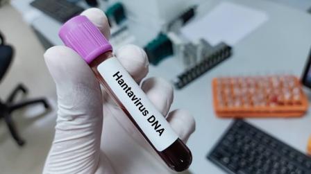 Emergencia sanitaria hantavirus_img