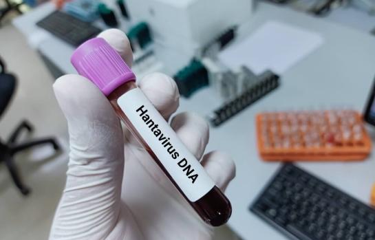 Emergencia sanitaria hantavirus_img